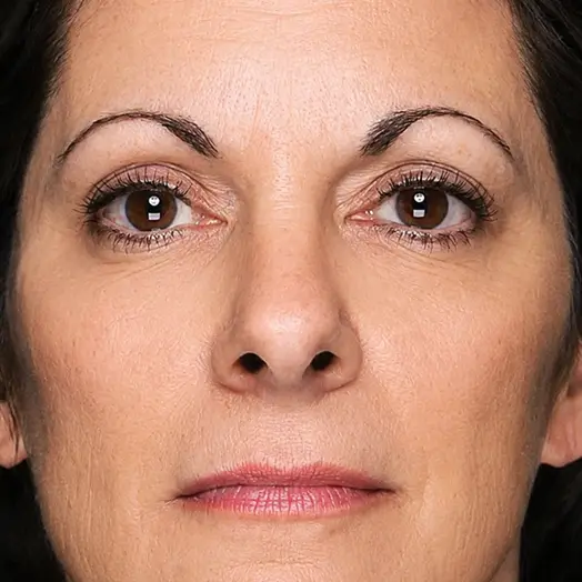 s3-comparision-img-after