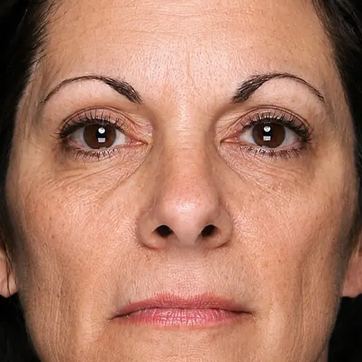 s3-comparision-img-before